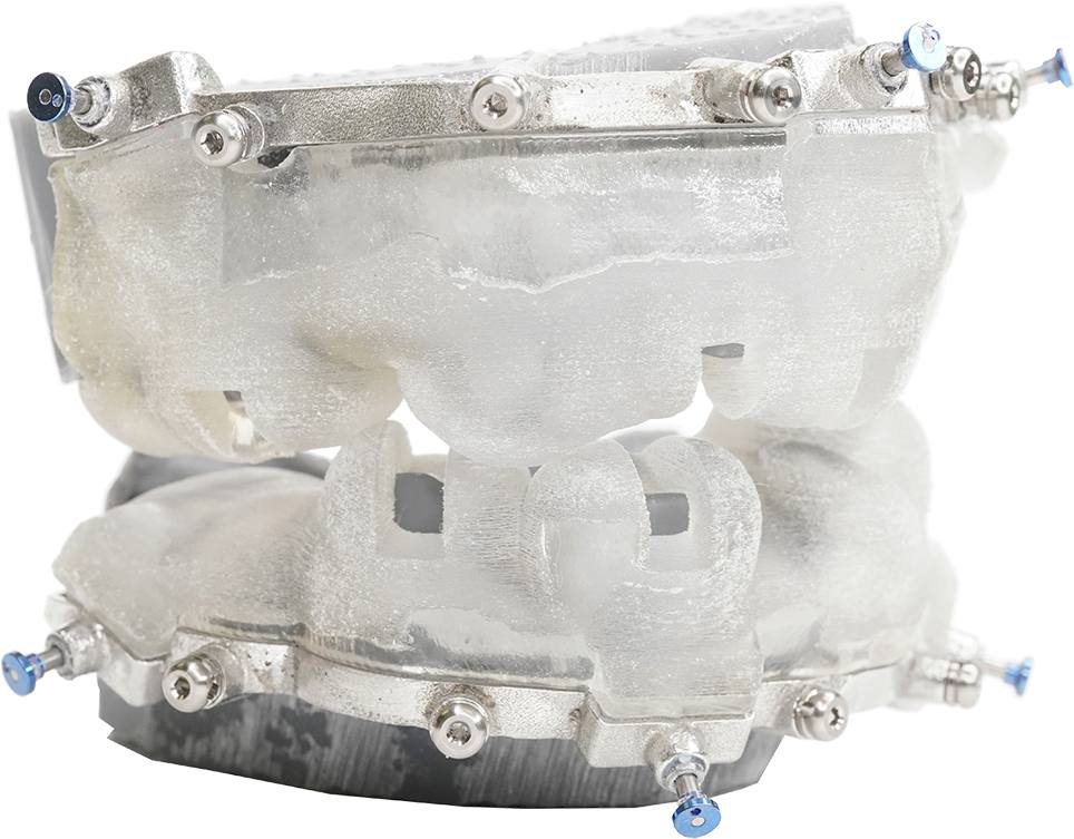 Chrome™ Full Arch Guided Smile — Otella Dental