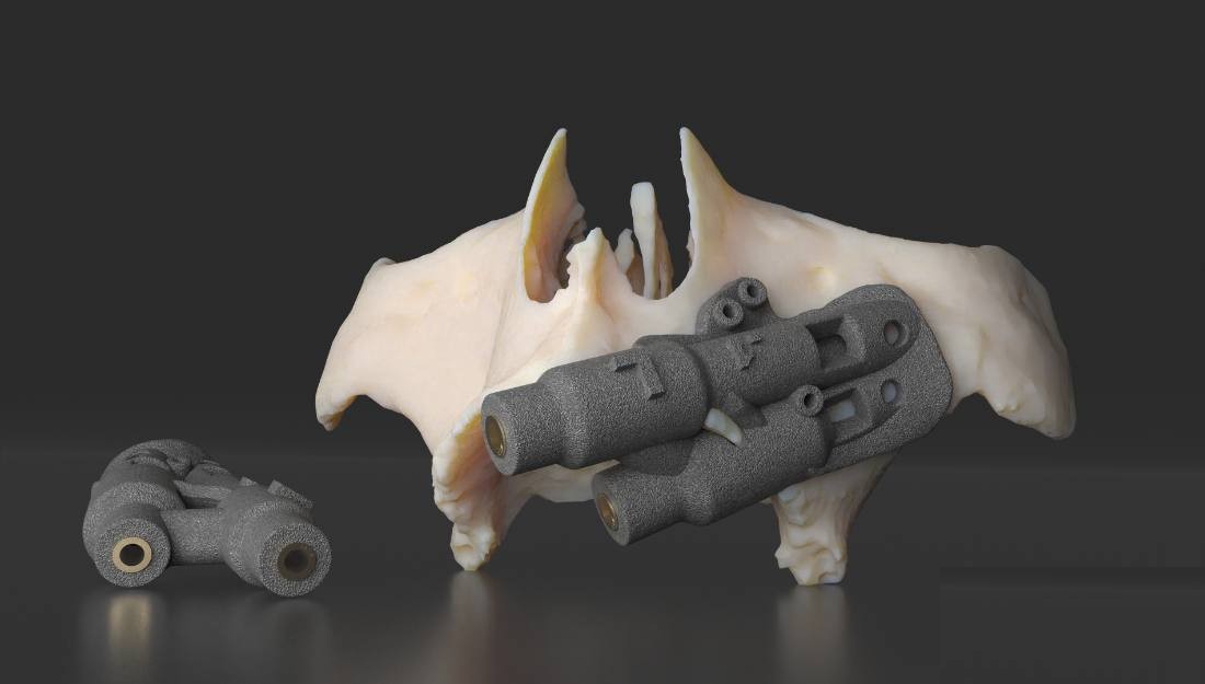 Zygoma & Pterygoid Surgical Guides
