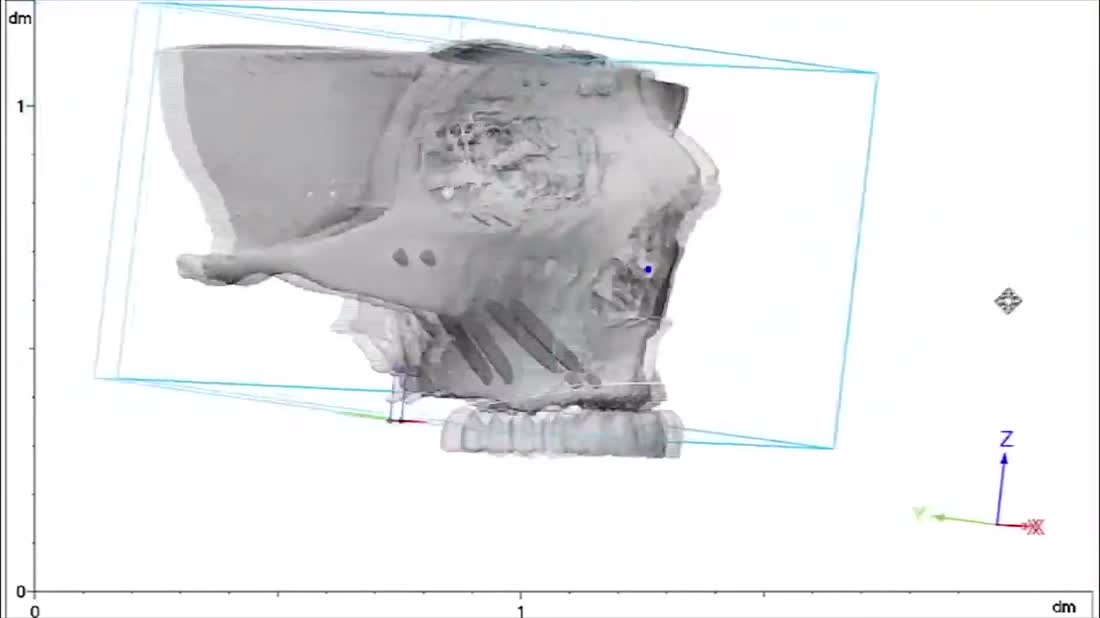 Digital surgical planning — Otella Dental