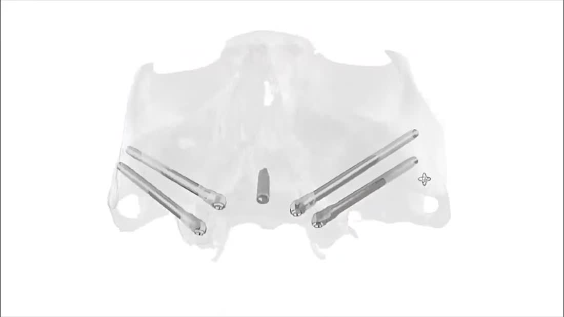 Digital surgical planning — Otella Dental