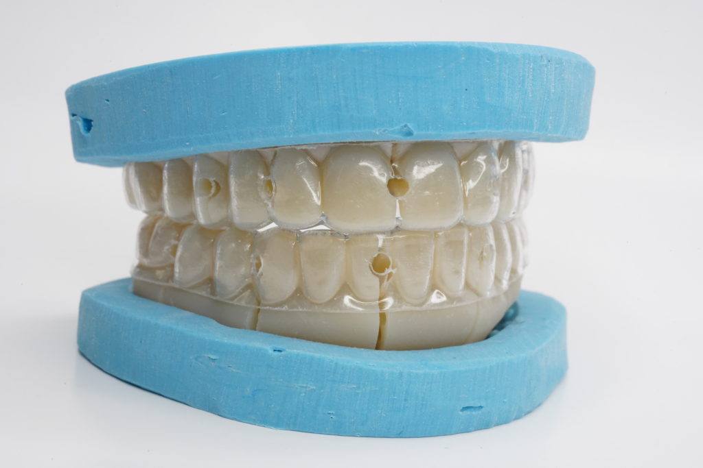 Chrome™ Full Arch Guided Smile — Otella Dental