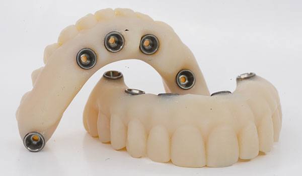 Chrome™ Full Arch Guided Smile — Otella Dental