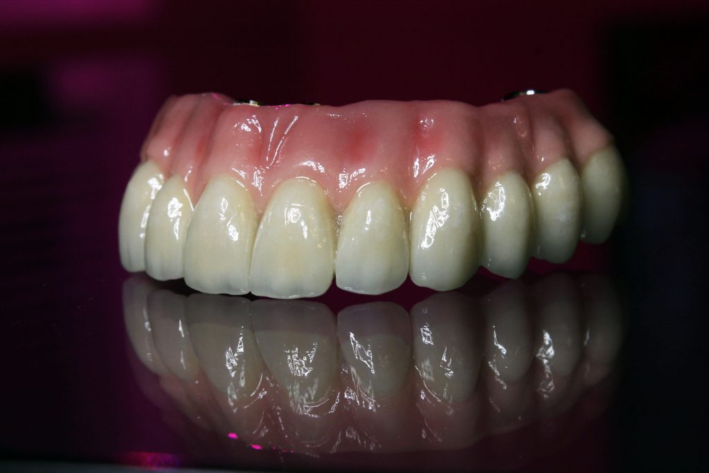 Otella Dental | Acrylic Dentures